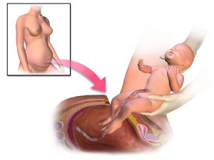 После родов болит желудок лечение thumbnail